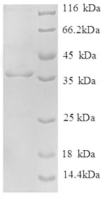 Human NDUFA2 protein