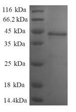 Human C1D protein