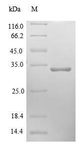 Human UQCR protein