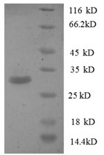 Human KIAA0024 protein