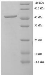 Human BC2 protein