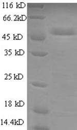 Human UQCRFS1 protein