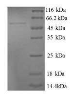 Human MRPL9 protein