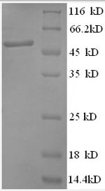Human ANAPC5 protein