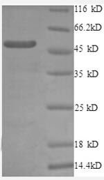 Human RPL10A protein