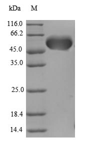 Human AATF CHE1 protein