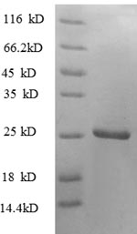 Human CD137L protein