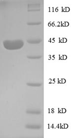 Human PP1446 protein