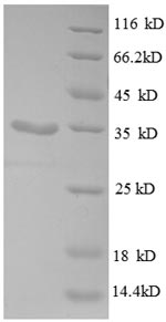 E.coli rpsU protein