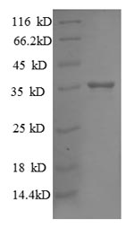 E.coli rpsR protein