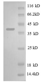 E.coli rpsM protein