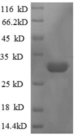 E.coli rpmJ protein