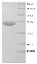 E.coli rpmF protein
