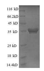 E.coli rpmB protein