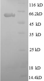 Human SPARC ON protein