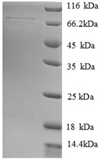 Human HSPA13 protein