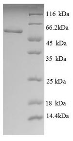 Human LCAT protein