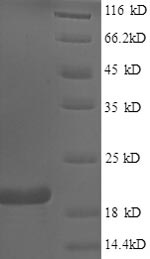Human FHIT protein
