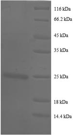 Human CD147 protein
