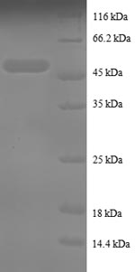 Human TNFAIP8 protein