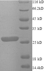 Human ZMAT2 protein