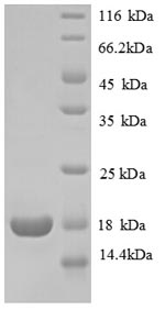 Human RPL31 protein