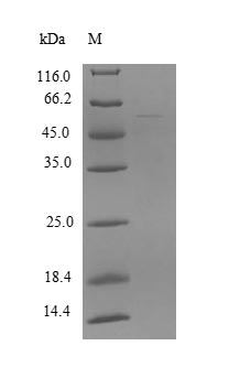 Human ZSCAN21 protein