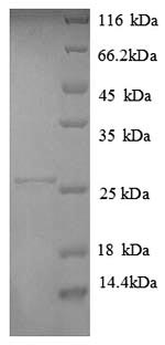 Human HLA-DPA1 protein