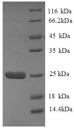 Human HLA-DQA2 protein
