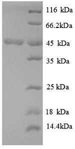 E.coli pdh protein