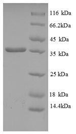 Human HLA-C protein