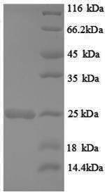 Rat Hras1 protein