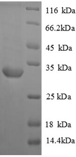 Rat Avpr1a protein