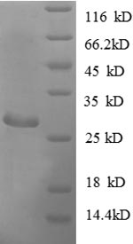 E. coli adk protein