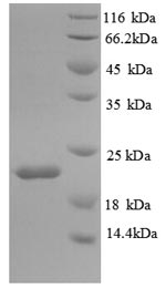 Mouse Il18bp protein
