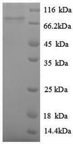 E. coli speF protein