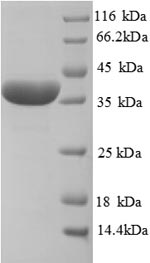 Rat Haptoglobin protein
