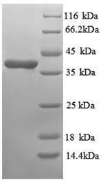Human ANXA3 protein