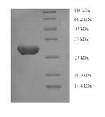 Human ASGR1 protein