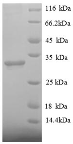 Human HDAC7 protein