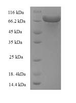 E. coli zwf protein