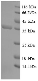 E. coli dapA protein