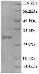 E. coli fre protein