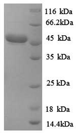 E.coli CE2118 protein