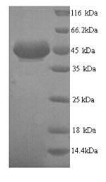 Human ADH7 protein