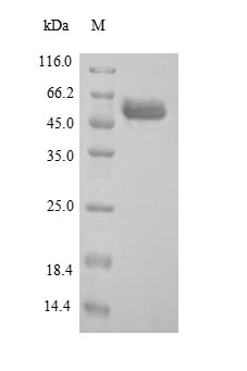 Human ARSB protein
