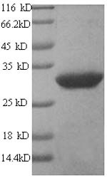Human ART1 protein
