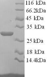 Mouse Asgr1 protein