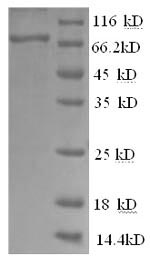 Human Btk protein