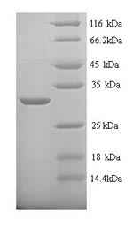 Rat Ca1 protein